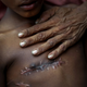 Mohammed Shoaib, 7, who was shot in his chest before crossing the border from Myanmar in August, is held by his father outside a medical centre near Cox’s Bazar, Bangladesh, Nov. 5, 2017.